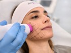 Demostene Center - Medicina Estetica Rigenerativa, Dott.ssa M.C. Costantino e Dott.ssa R. Gaccetta, Axa Casal Palocco