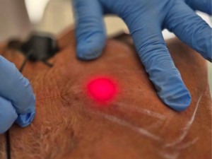 Clinica Estetica Roma Sud - Axa Casalpalocco,  EvolveX, Epilazione Laser, Carbossiterapia e Criolipolisi